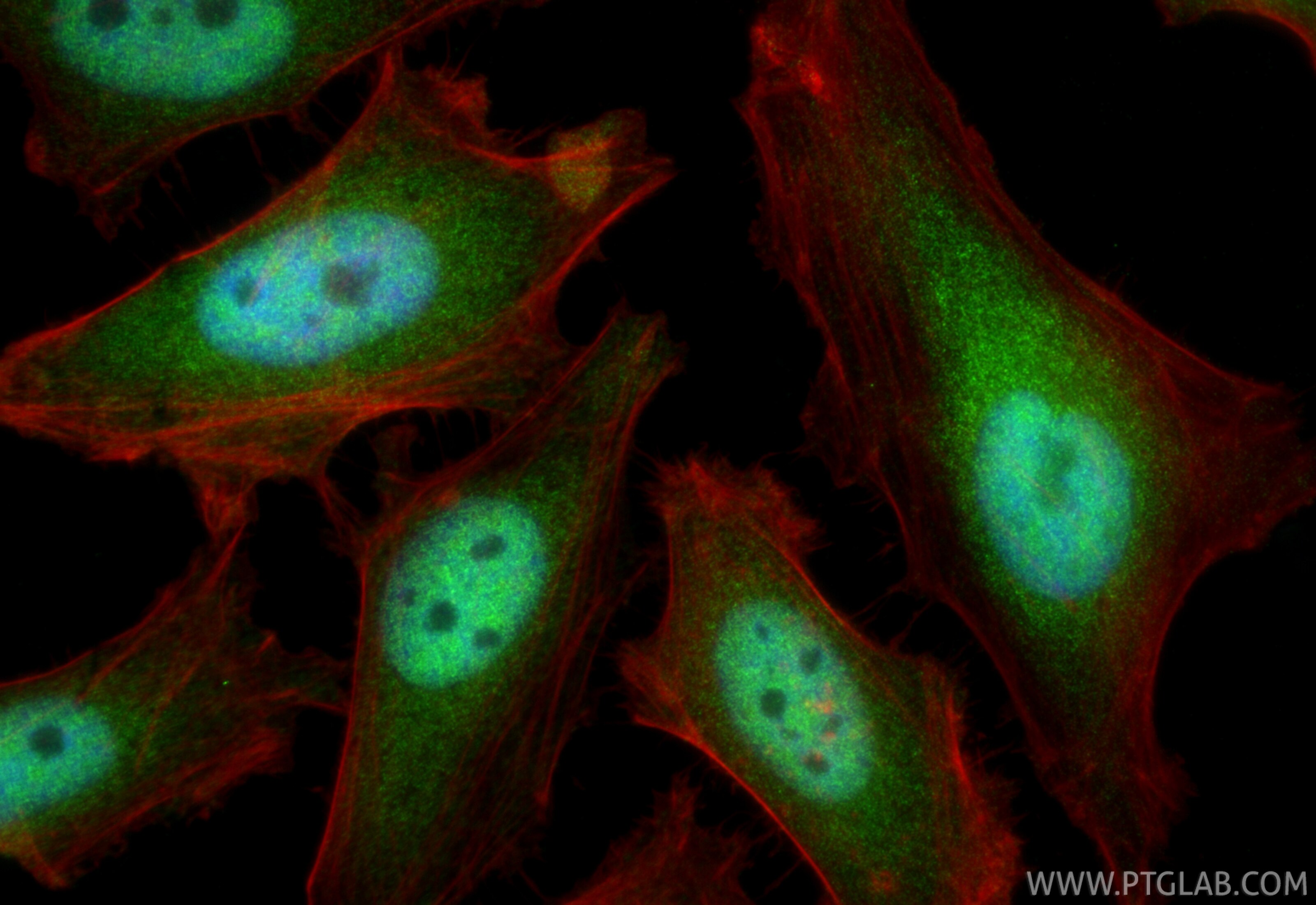 Immunofluorescent analysis of (4% PFA) fixed HeLa cells using UBE4B antibody (85332-2-RR, Clone: 242218E4 ) at dilution of 1:1000 and CoraLite®488-Conjugated Goat Anti-Rabbit IgG(H+L) (SA00013-2), CL594-Phalloidin (red). Immunofluorescence (IF) / fluorescent staining of HeLa cells using UBE4B Recombinant monoclonal antibody (85332-2-RR)