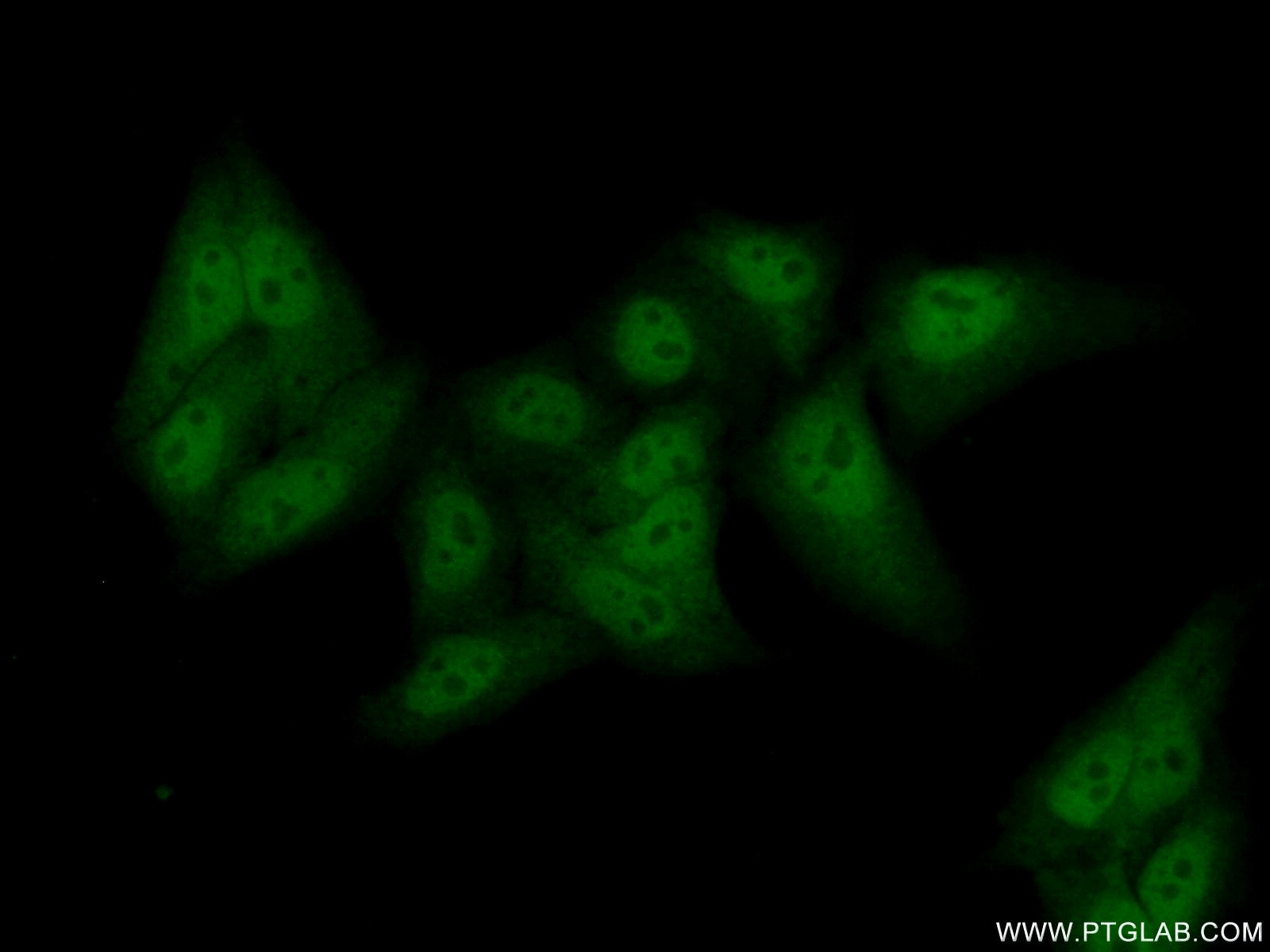 Immunofluorescence (IF) / fluorescent staining of HepG2 cells using UBF1 Polyclonal antibody (20660-1-AP)