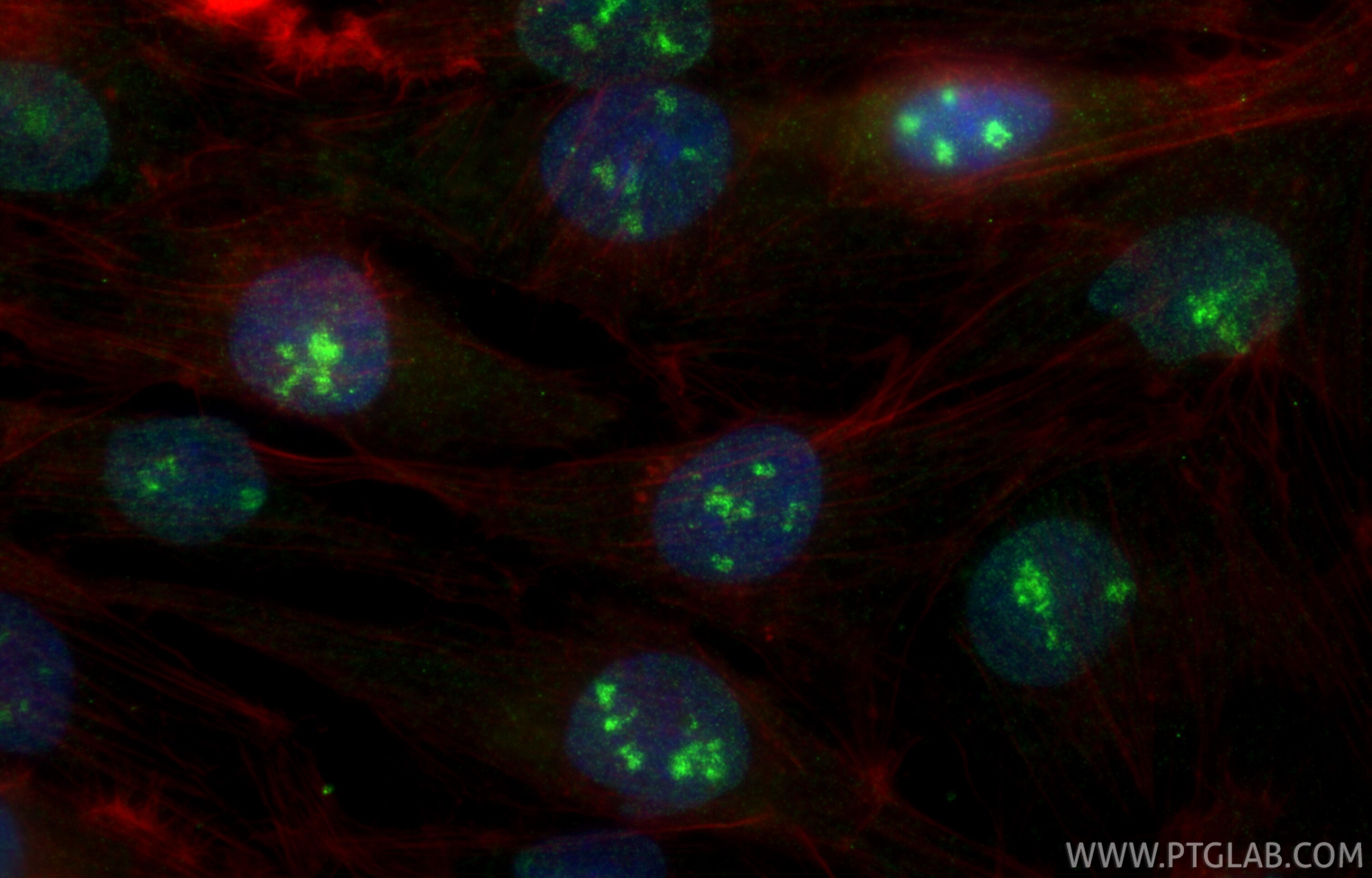 IF Staining of ROS1728 using 32161-1-AP (same clone as 32161-1-PBS) Immunofluorescence (IF) / fluorescent staining of ROS1728 cells using UBFD1 Polyclonal antibody (32161-1-AP)