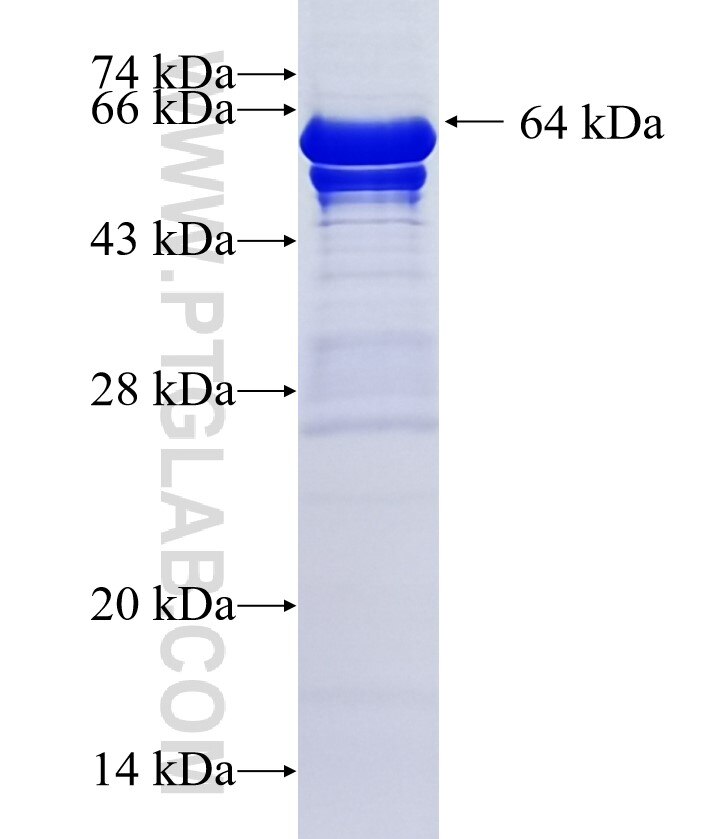 UBFD1 fusion protein Ag36361 SDS-PAGE