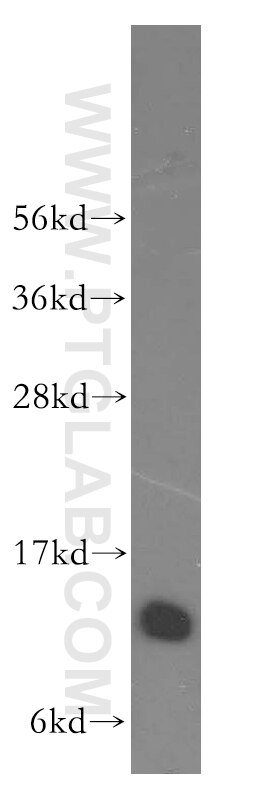 Western Blot (WB) analysis of human brain tissue using UBL3 Polyclonal antibody (14100-1-AP)