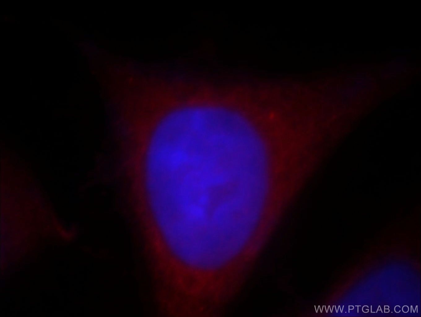 Immunofluorescence (IF) / fluorescent staining of HeLa cells using UBL4B Polyclonal antibody (14509-1-AP)