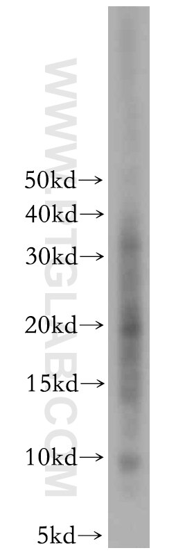 UBL5