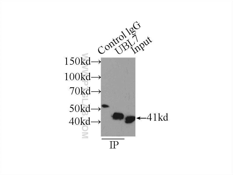 Immunoprecipitation (IP) experiment of HeLa cells using BMSC UbP Polyclonal antibody (11564-1-AP)