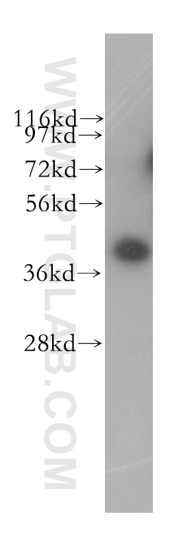 Western Blot (WB) analysis of HeLa cells using BMSC UbP Polyclonal antibody (11564-1-AP)