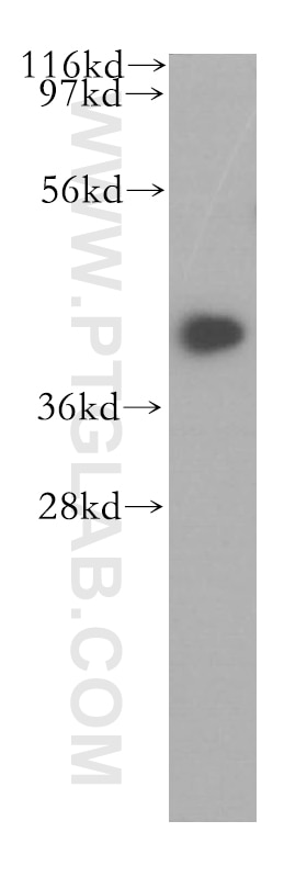 Western Blot (WB) analysis of Jurkat cells using BMSC UbP Polyclonal antibody (11564-1-AP)