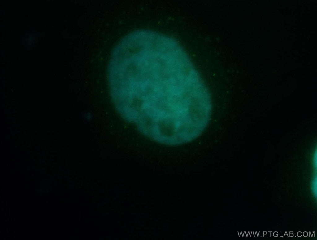 Immunofluorescence (IF) / fluorescent staining of HeLa cells using UBLCP1 Polyclonal antibody (12099-1-AP)