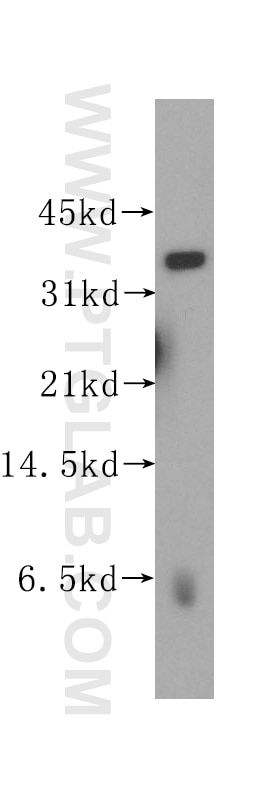 Western Blot (WB) analysis of human brain tissue using UBLCP1 Polyclonal antibody (12099-1-AP)