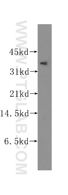 Western Blot (WB) analysis of K-562 cells using UBLCP1 Polyclonal antibody (12099-1-AP)