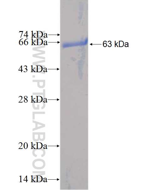 UBLCP1 fusion protein Ag2743 SDS-PAGE