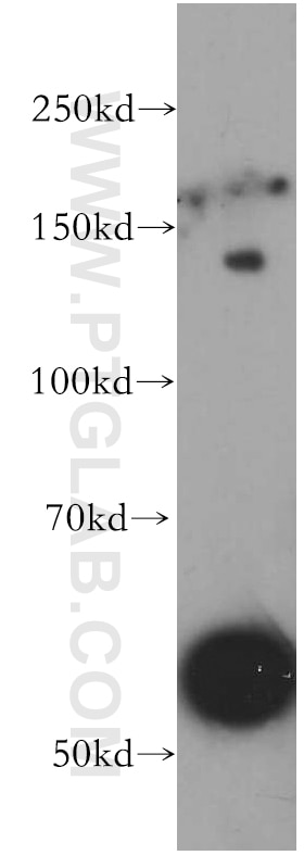 Western Blot (WB) analysis of mouse liver tissue using UBN1-Specific Polyclonal antibody (20363-1-AP)