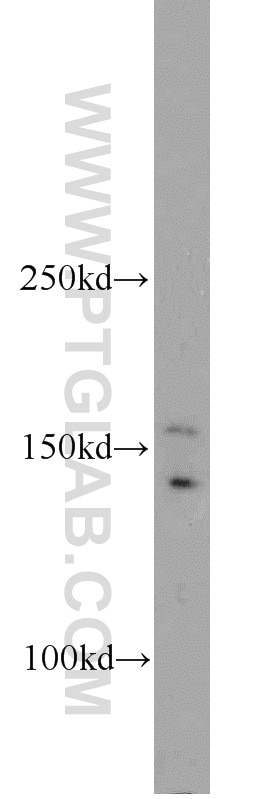 Western Blot (WB) analysis of MCF-7 cells using UBN1-Specific Polyclonal antibody (20363-1-AP)
