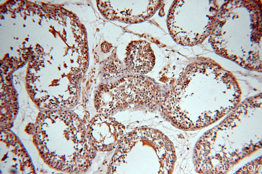 Immunohistochemistry (IHC) staining of human testis tissue using UBN2 Polyclonal antibody (18844-1-AP)