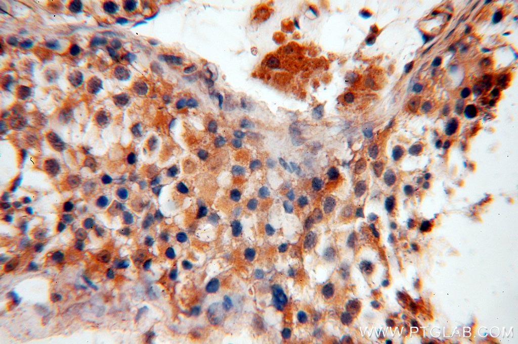 Immunohistochemistry (IHC) staining of human testis tissue using UBN2 Polyclonal antibody (18844-1-AP)