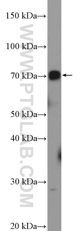 Western Blot (WB) analysis of mouse kidney tissue using UBOX5 Polyclonal antibody (14815-1-AP)
