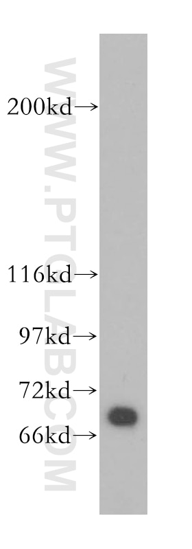 Western Blot (WB) analysis of human kidney tissue using UBP1 Polyclonal antibody (13856-1-AP)