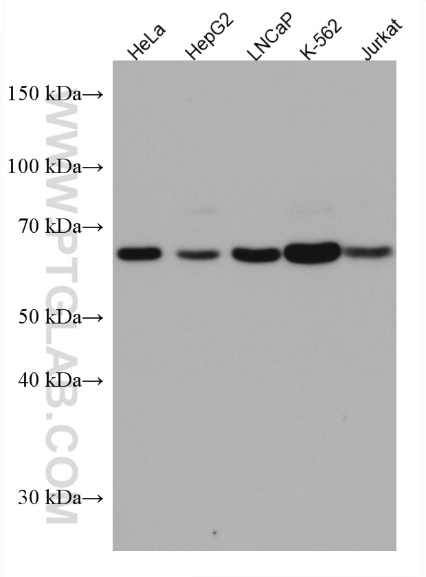 Western Blot (WB) analysis of various lysates using UBP1 Monoclonal antibody (67318-1-Ig)