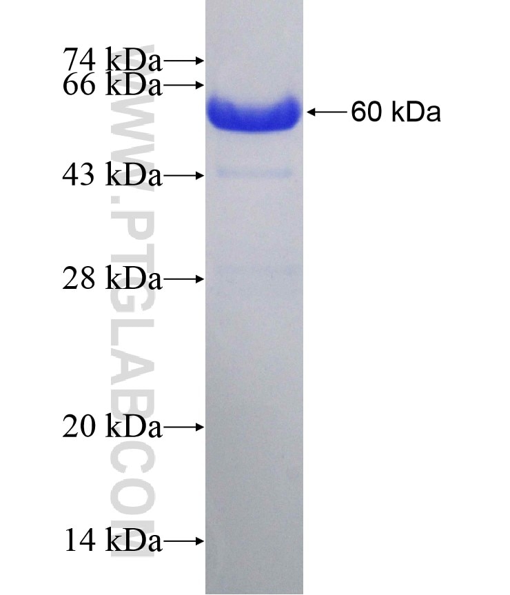 UBP1 fusion protein Ag4830 SDS-PAGE