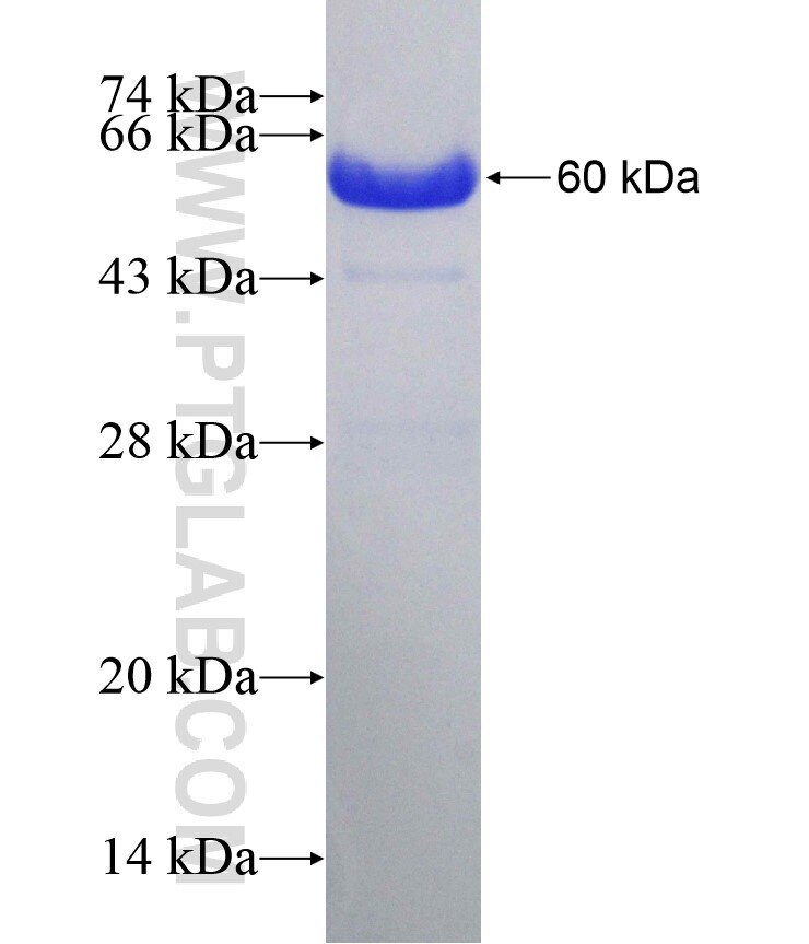 UBP1 fusion protein Ag4830 SDS-PAGE