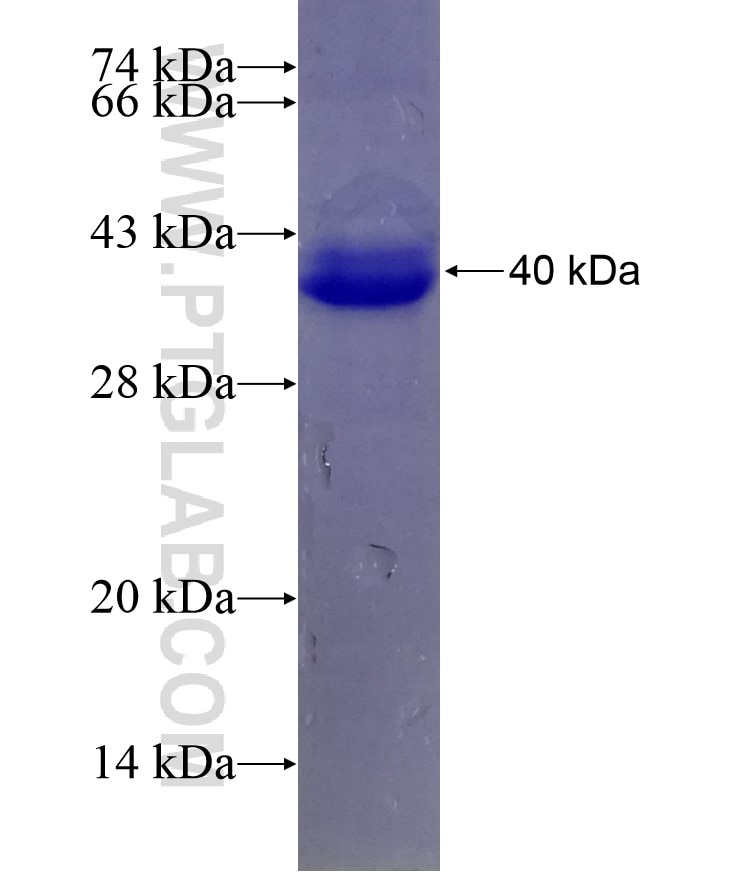 UBP1 fusion protein Ag5010 SDS-PAGE