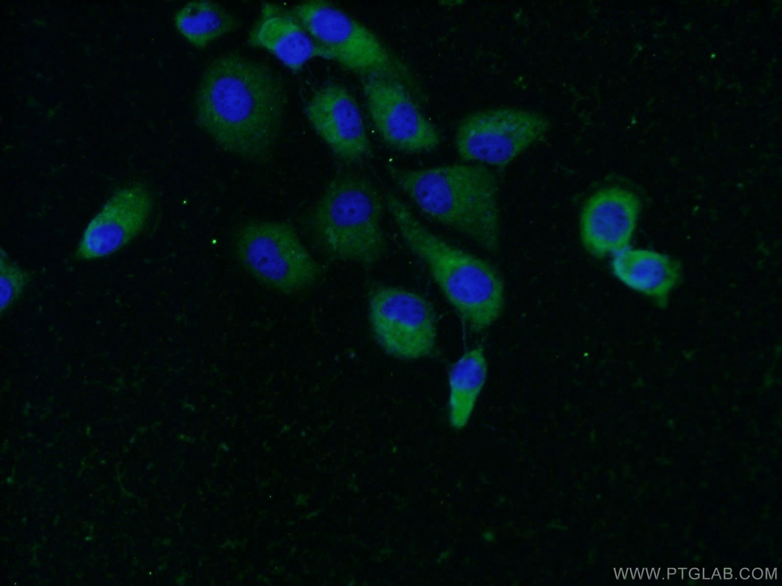 Immunofluorescence (IF) / fluorescent staining of A431 cells using UBQLN2 Polyclonal antibody (23449-1-AP)