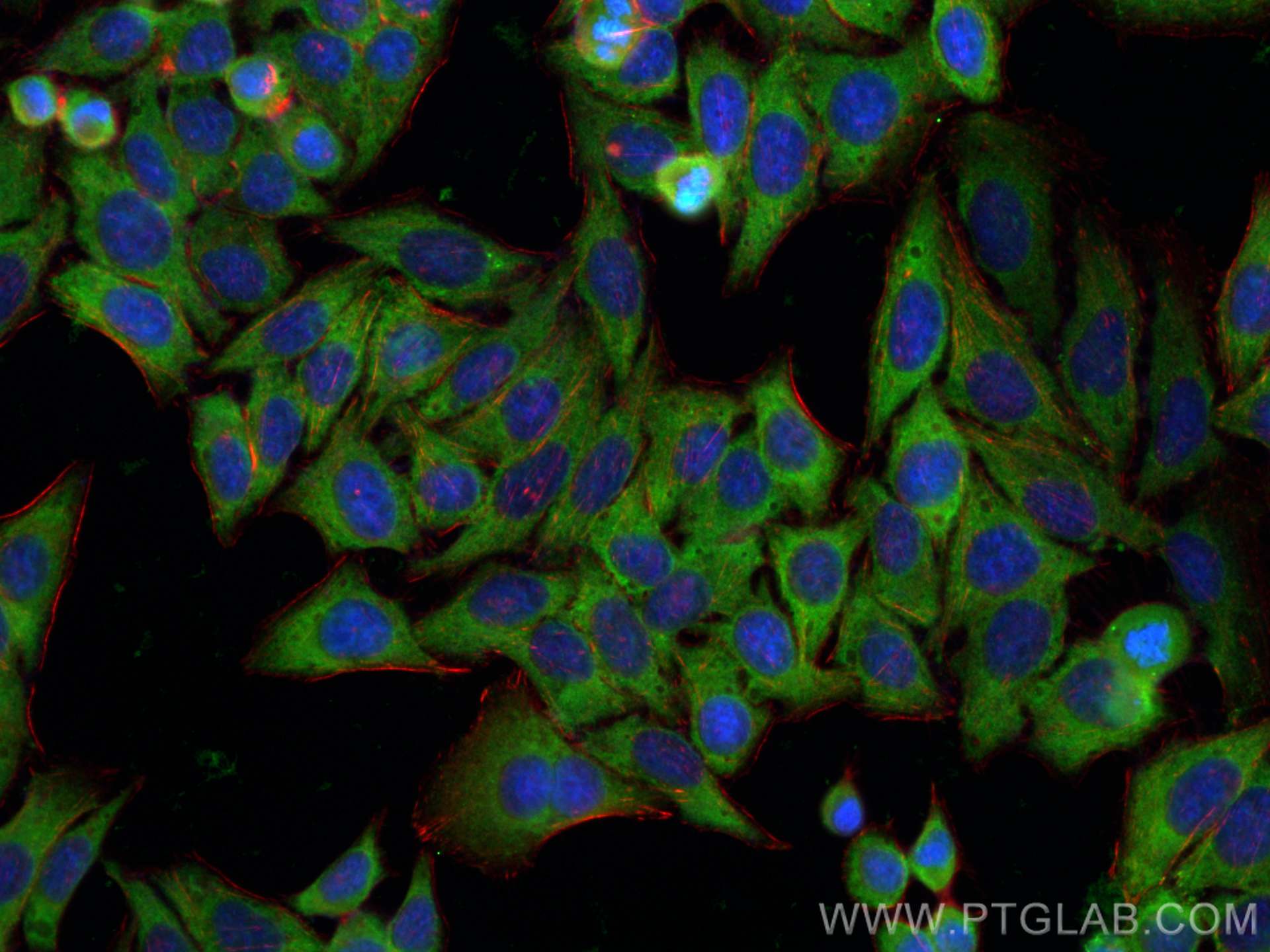 Immunofluorescence (IF) / fluorescent staining of HepG2 cells using UBQLN2 Polyclonal antibody (23449-1-AP)