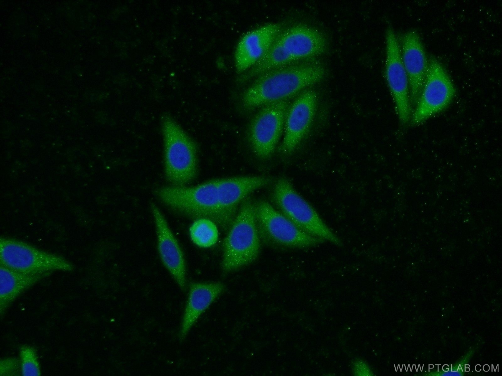 Immunofluorescence (IF) / fluorescent staining of HepG2 cells using UBQLN2 Polyclonal antibody (23449-1-AP)