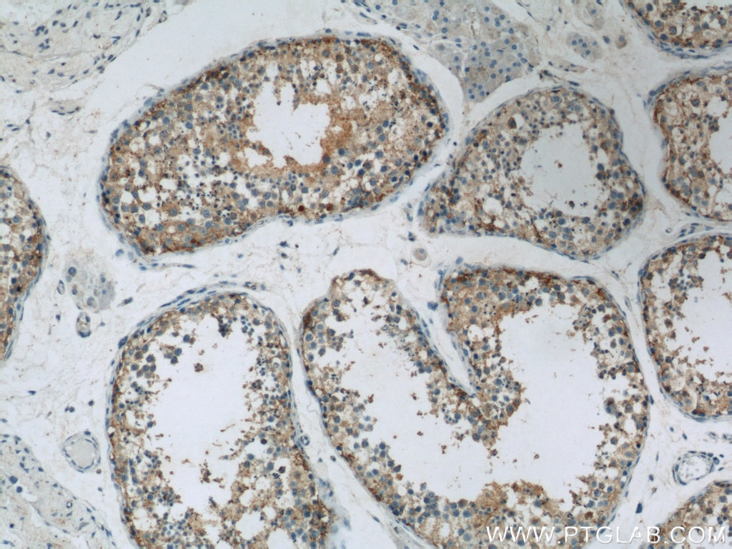 Immunohistochemistry (IHC) staining of human testis tissue using UBQLN2 Polyclonal antibody (23449-1-AP)