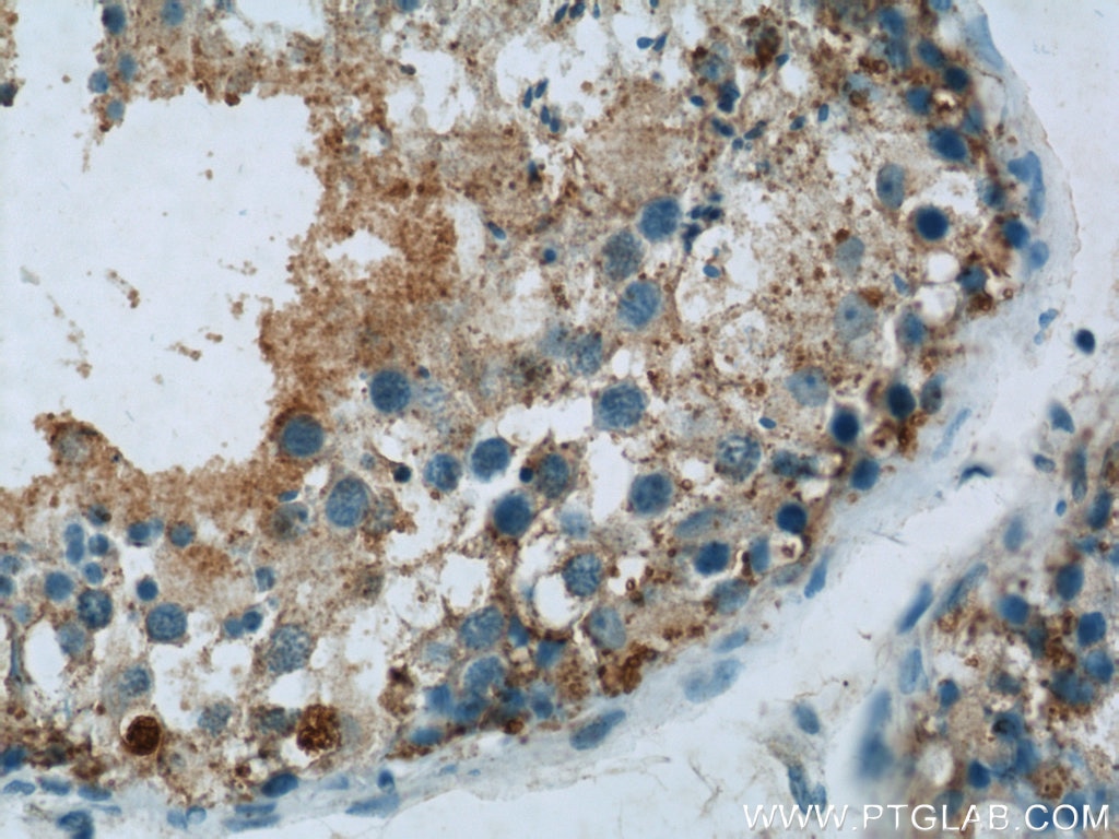 Immunohistochemistry (IHC) staining of human testis tissue using UBQLN2 Polyclonal antibody (23449-1-AP)