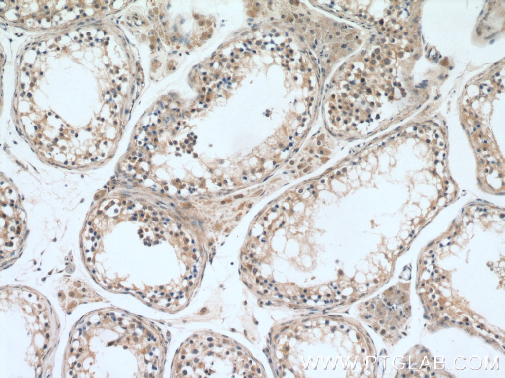 Immunohistochemistry (IHC) staining of human testis tissue using UBQLN2 Polyclonal antibody (23449-1-AP)