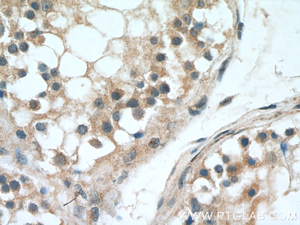 Immunohistochemistry (IHC) staining of human testis tissue using UBQLN2 Polyclonal antibody (23449-1-AP)