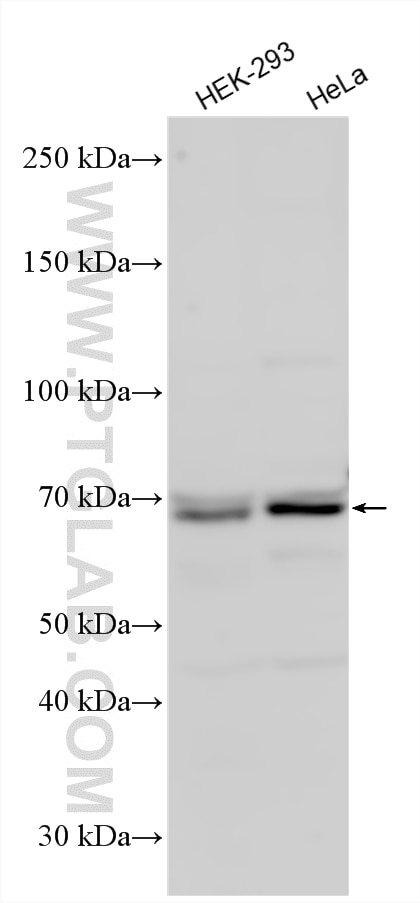 WB analysis using 23449-1-AP Western Blot (WB) analysis of various lysates using Ubiquilin 2 Polyclonal antibody (23449-1-AP)