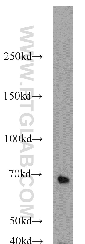 Western Blot (WB) analysis of HepG2 cells using UBQLN2 Polyclonal antibody (23449-1-AP)