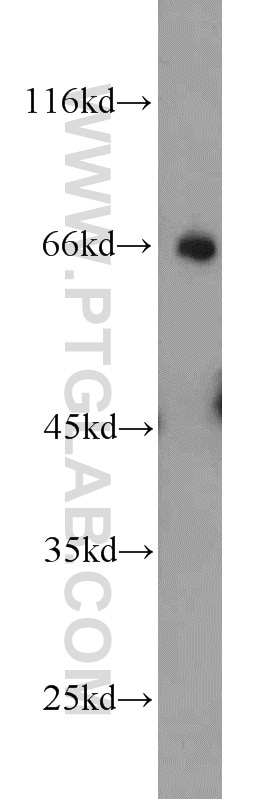 Western Blot (WB) analysis of HEK-293 cells using UBQLN2 Polyclonal antibody (23449-1-AP)