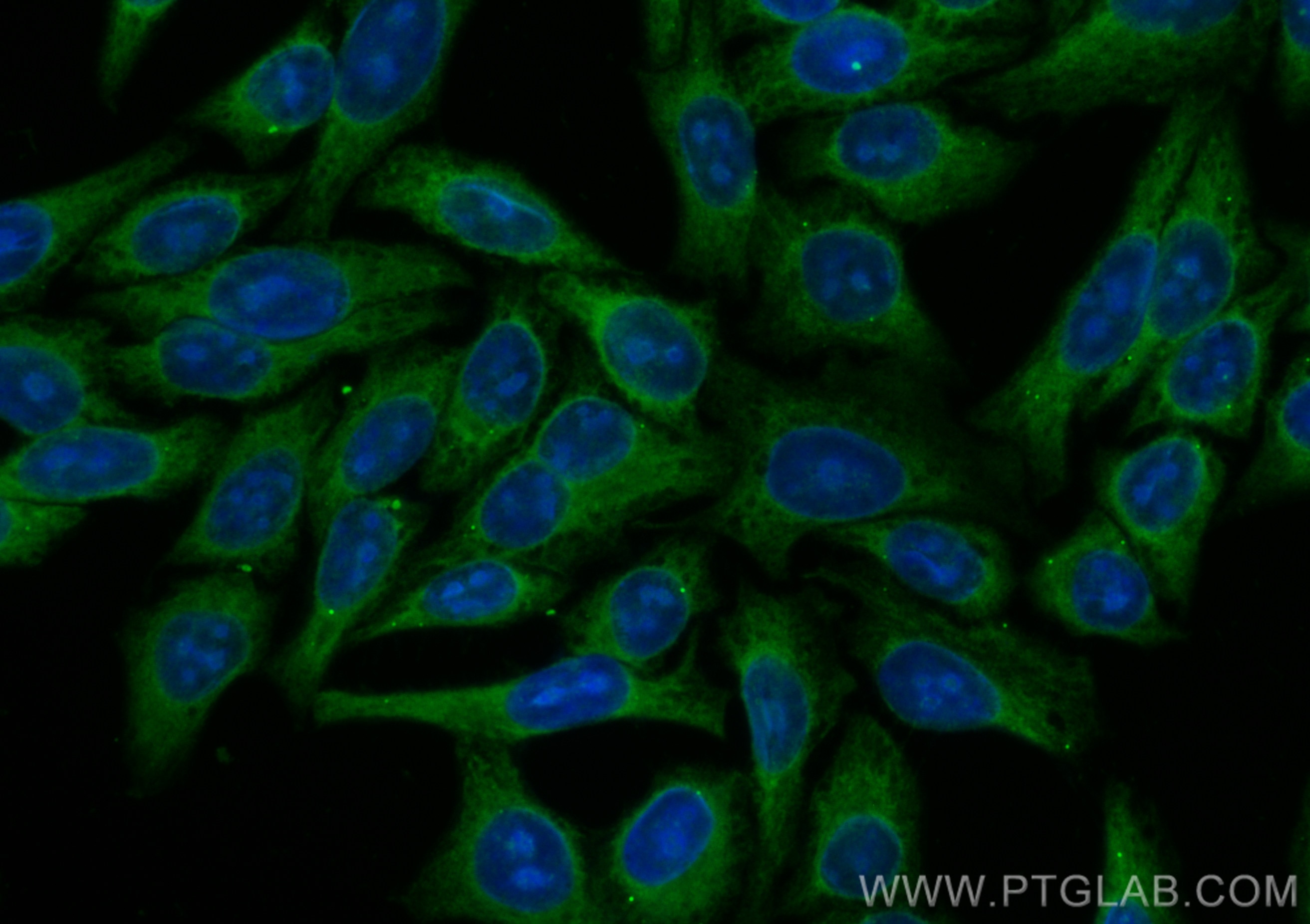 Immunofluorescence (IF) / fluorescent staining of HepG2 cells using CoraLite® Plus 488-conjugated UBQLN2 Polyclonal an (CL488-23449)