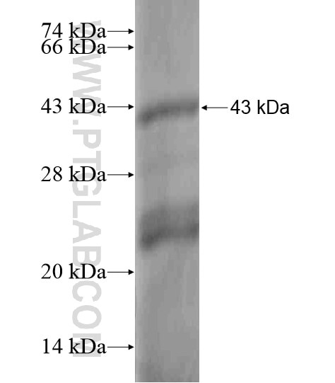 Ubiquilin 2 fusion protein Ag19940 SDS-PAGE