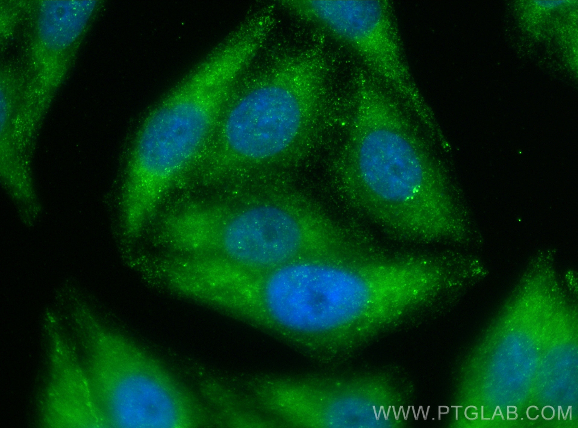 Immunofluorescence (IF) / fluorescent staining of HepG2 cells using UBQLN3 Polyclonal antibody (23372-1-AP)