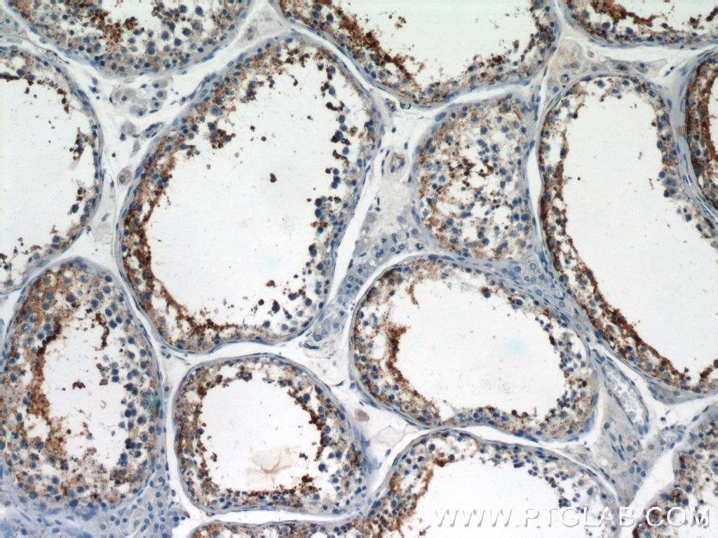 Immunohistochemistry (IHC) staining of human testis tissue using UBQLN3 Polyclonal antibody (23372-1-AP)