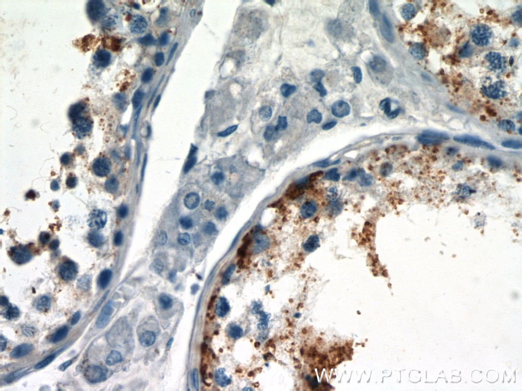 Immunohistochemistry (IHC) staining of human testis tissue using UBQLN3 Polyclonal antibody (23372-1-AP)
