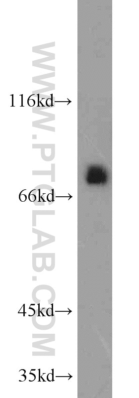 Western Blot (WB) analysis of human testis tissue using UBQLN3 Polyclonal antibody (23372-1-AP)