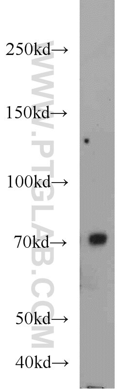 Western Blot (WB) analysis of mouse testis tissue using UBQLN3 Polyclonal antibody (23372-1-AP)