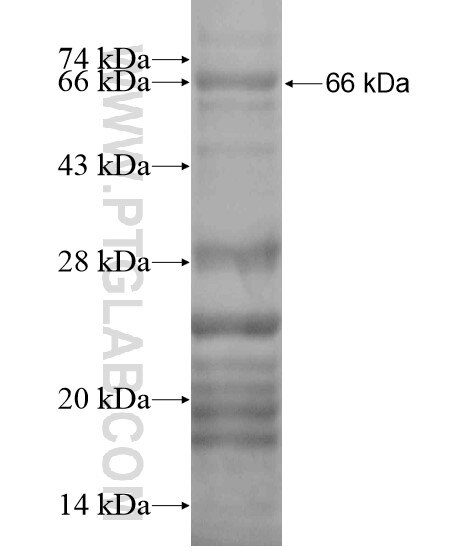 Ubiquilin 3 fusion protein Ag19982 SDS-PAGE