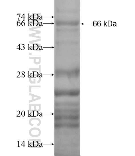 Ubiquilin 3 fusion protein Ag19982 SDS-PAGE