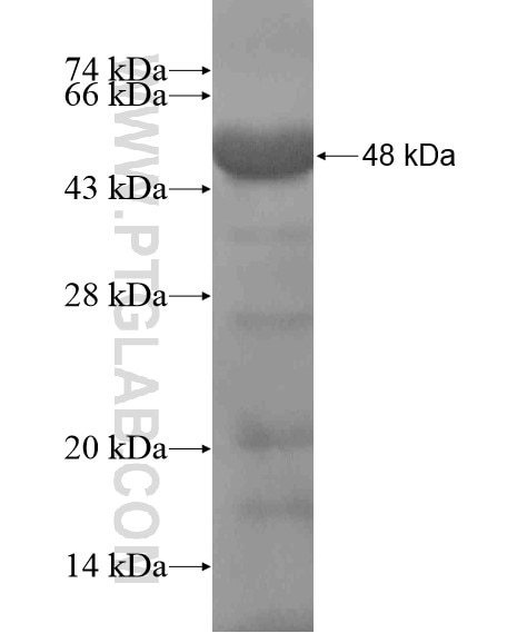 Ubiquilin 3 fusion protein Ag19988 SDS-PAGE
