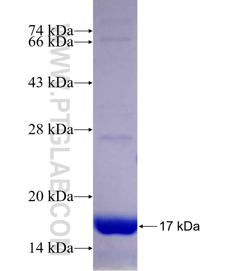 UBQLN4 fusion protein Ag29898 SDS-PAGE