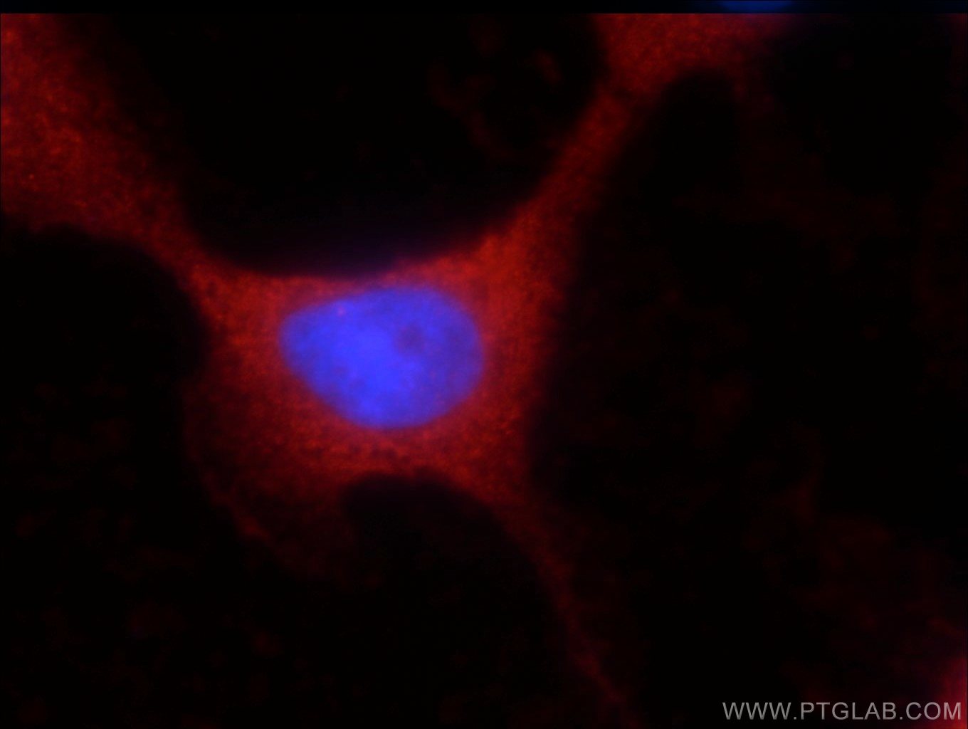 Immunofluorescence (IF) / fluorescent staining of A431 cells using UBQLNL Polyclonal antibody (16400-1-AP)