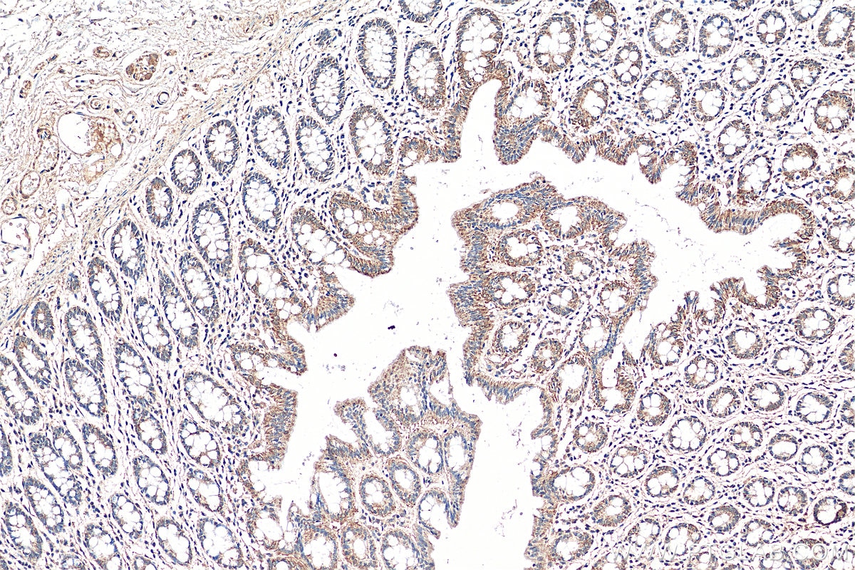 Immunohistochemistry (IHC) staining of human colon tissue using UBQLNL Polyclonal antibody (16400-1-AP)