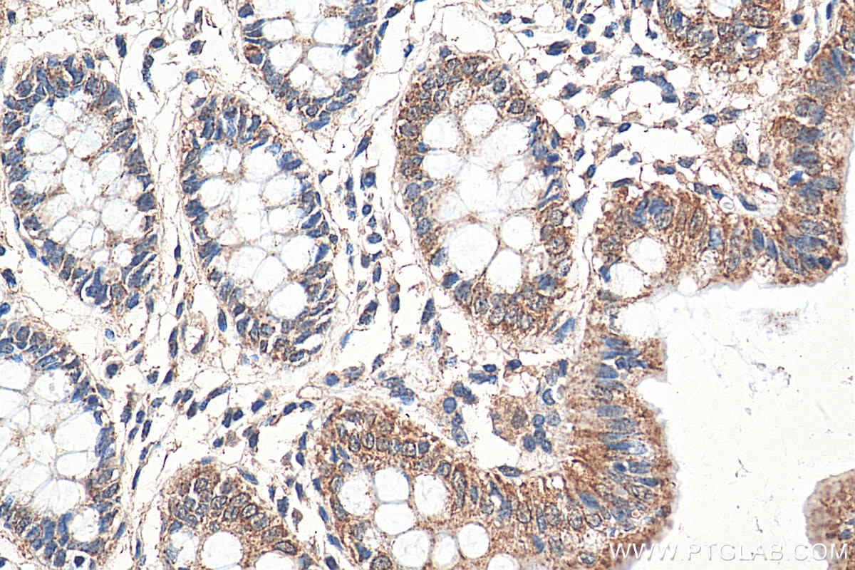 Immunohistochemistry (IHC) staining of human colon tissue using UBQLNL Polyclonal antibody (16400-1-AP)