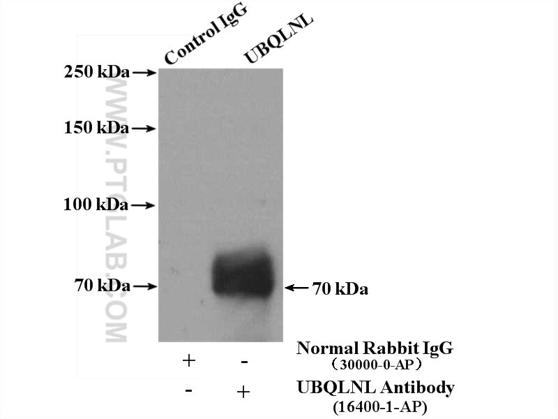 Immunoprecipitation (IP) experiment of Jurkat cells using UBQLNL Polyclonal antibody (16400-1-AP)