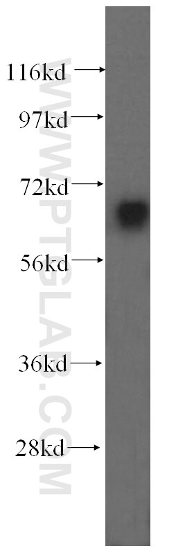 Western Blot (WB) analysis of human brain tissue using UBQLNL Polyclonal antibody (16400-1-AP)